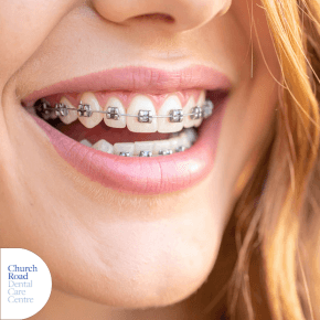 a smiling mouth with braces