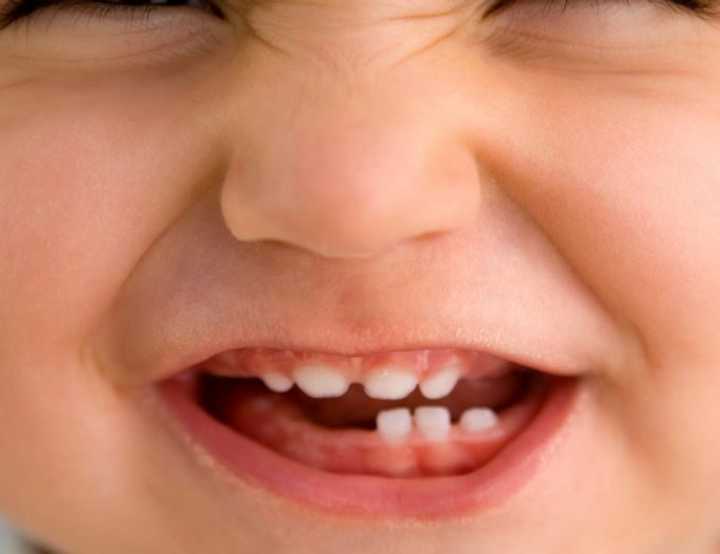 Toddler smiling at the camera showing teeth